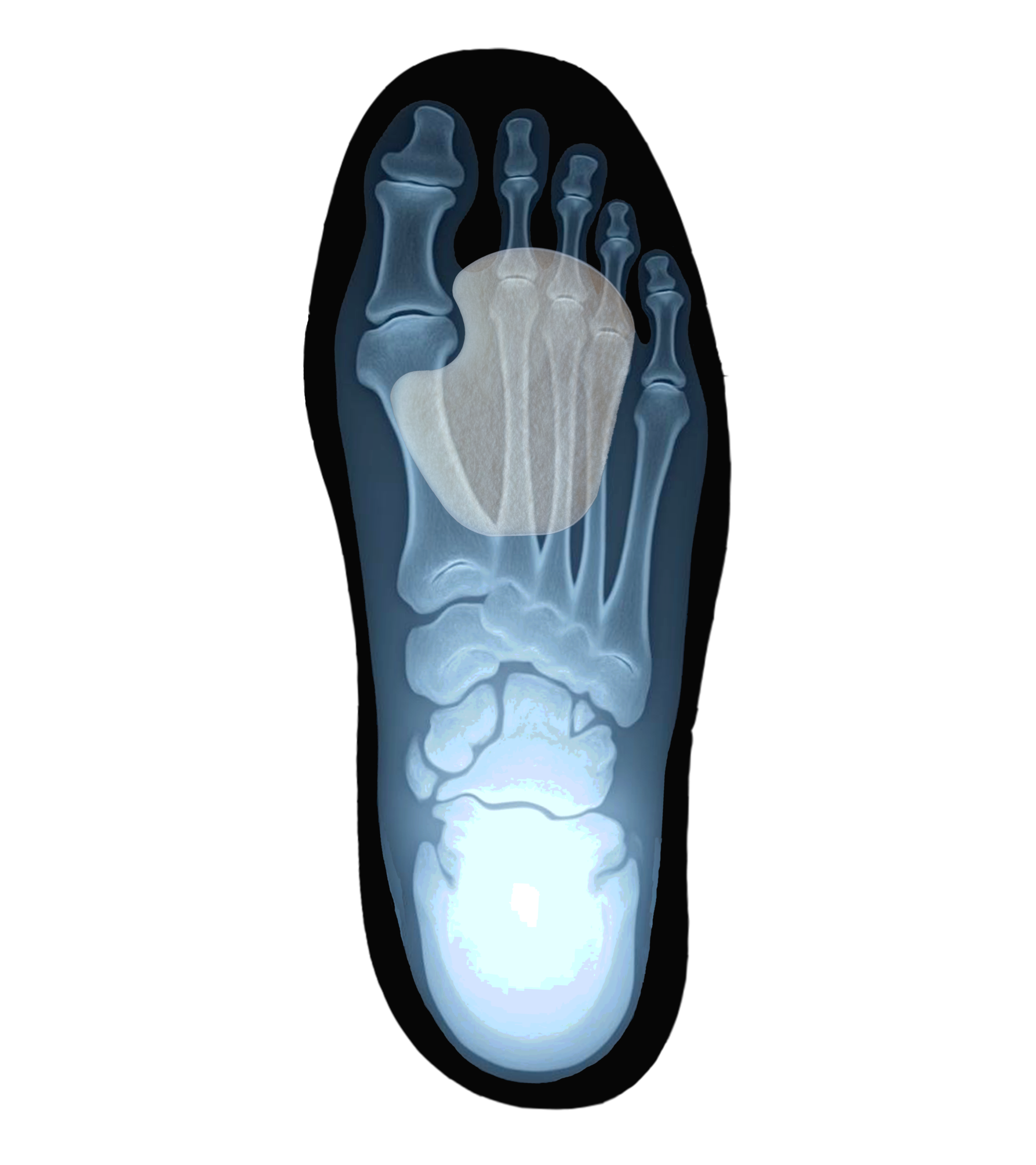 Dancer Pads - Image 2